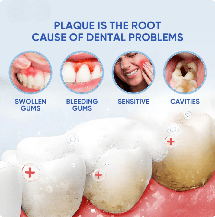 Instant Whitening Toothpaste