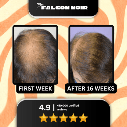 Falcon Noir™ Pumpkin Seed Oil Capsules